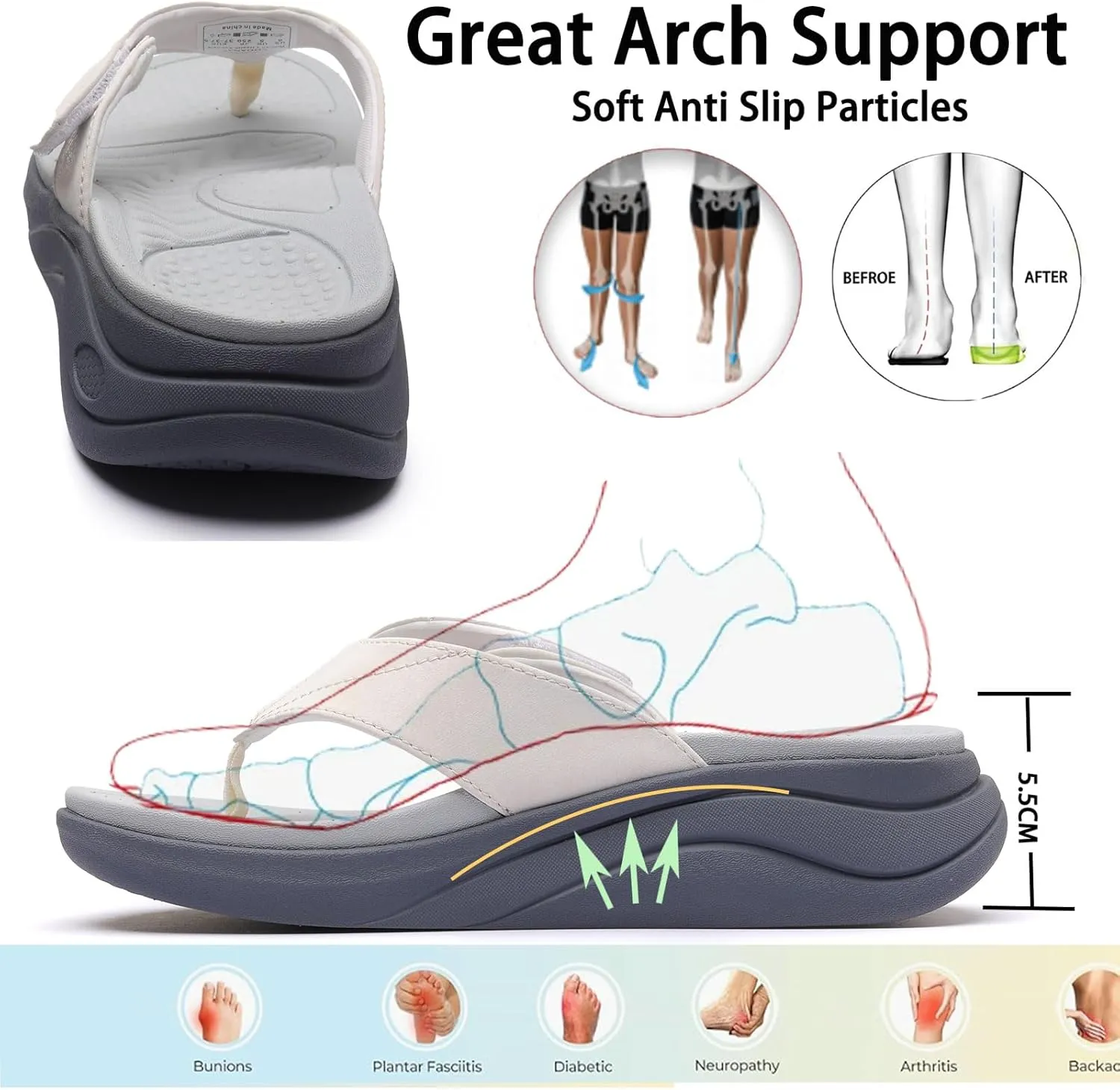 Sandals for Women with Adjustable Width Arch Support Orthotic for Swollen Feet | Foot Pain Relief